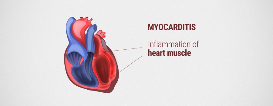 CBD: A Potential Therapeutic For Cardiovascular Diseases - RQS Blog