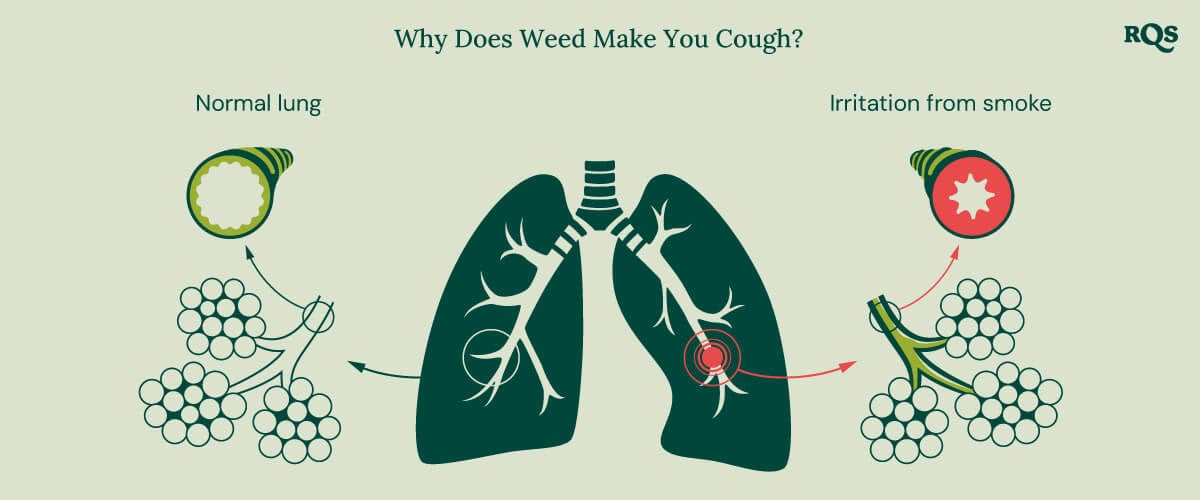 Diagram of healthy lung vs. irritated lung with inflammation and swollen bronchial tubes caused by smoking marijuana.