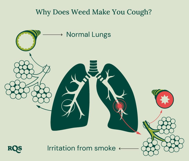 Diagram of healthy lung vs. irritated lung with inflammation and swollen bronchial tubes caused by smoking marijuana.